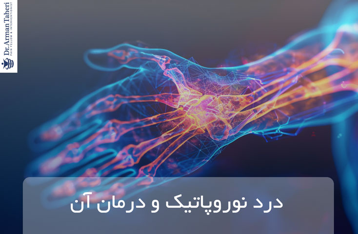 درد نوروپاتیک