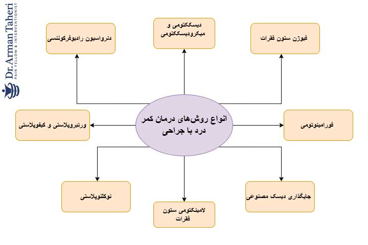 انواع روش های درمان کمر درد با جراحی