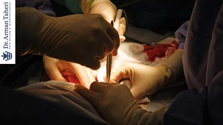 درمان کمر درد با جراحی